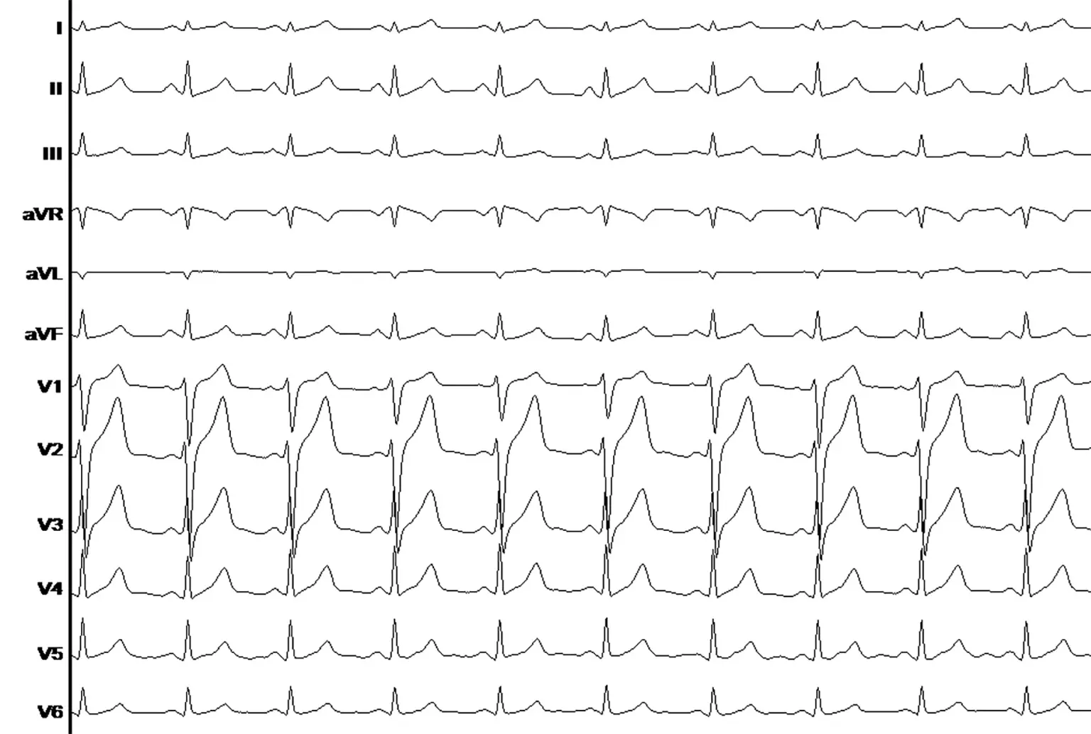 Image d'un ECG cardiaque Image d'un ECG cardiaque
